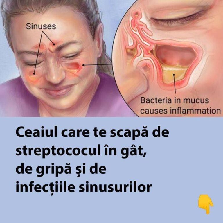 Ceaiul care te scapă de streptococul în gât, gripă și infecțiile sinusurilor – Remediu natural cu oregano