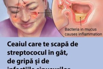 Ceaiul care te scapă de streptococul în gât, de gripă și de infecțiile sinusurilor – Cum se prepară